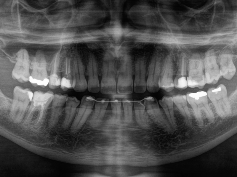 Radiografia panorâmica