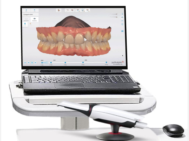 Escaneamento intraoral